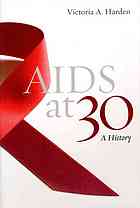 AIDS at 30: A History